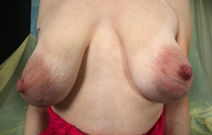 Big natural tits with stretch marks