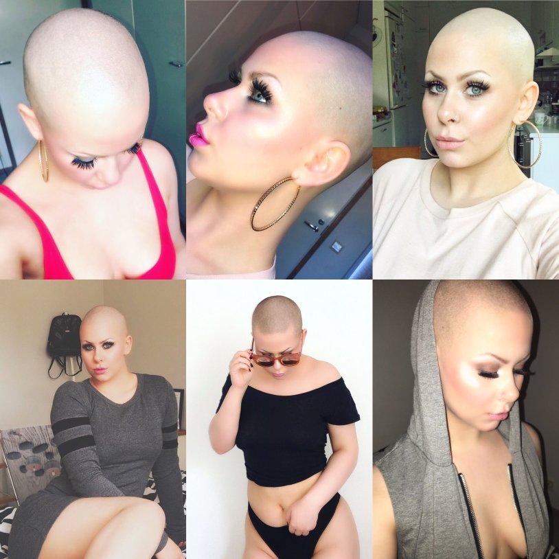Bald woman