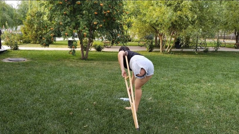 Daniella alvarez amputee