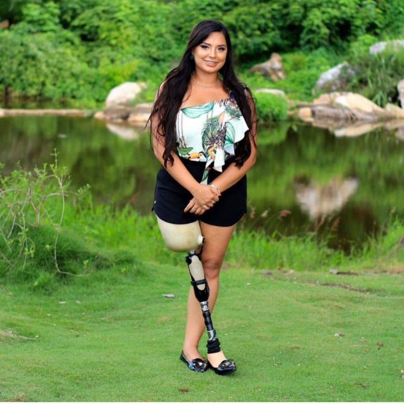 Women without a foot on crutches