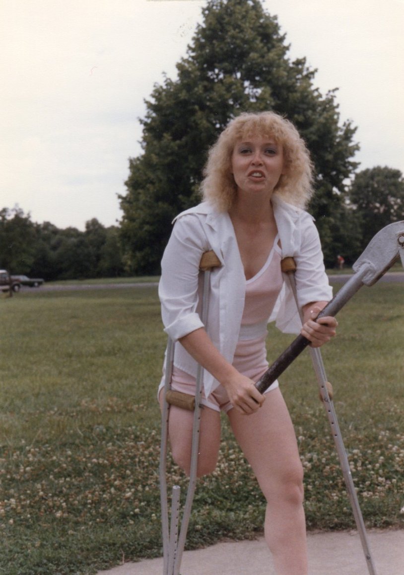 Nadira Aukhadieva amputa