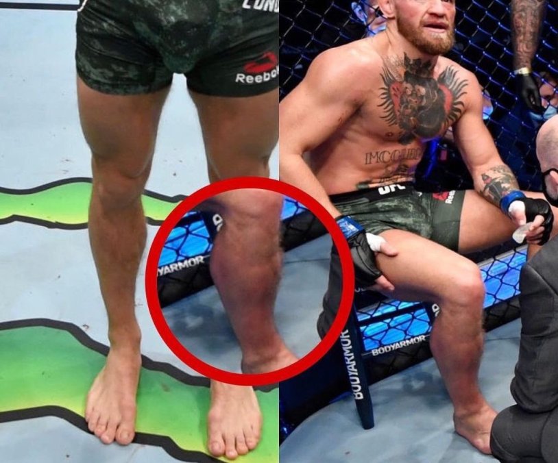 Khabib Nurmagomedov vs Conor McGregor