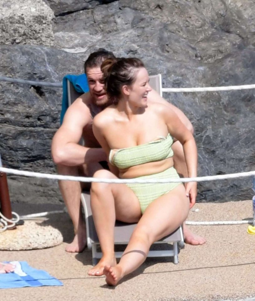 Conor McGregor fight leg