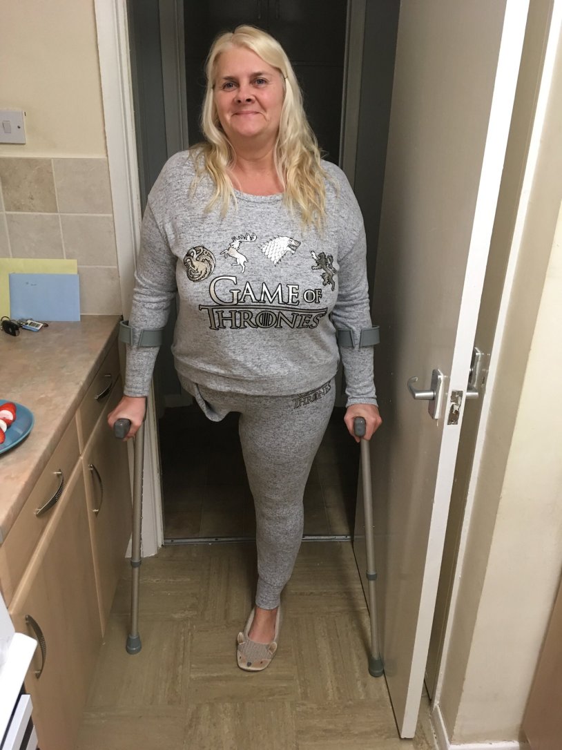 Disabledplanet. Free amputee pictures.page 001