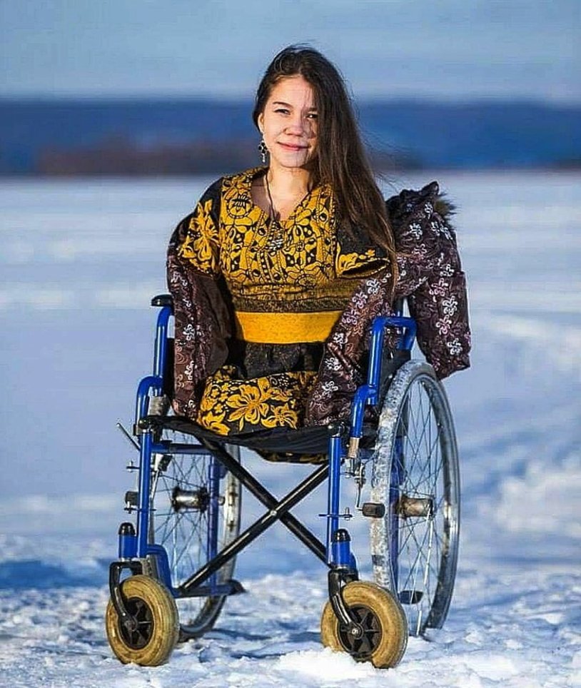 Amputa women in underwear