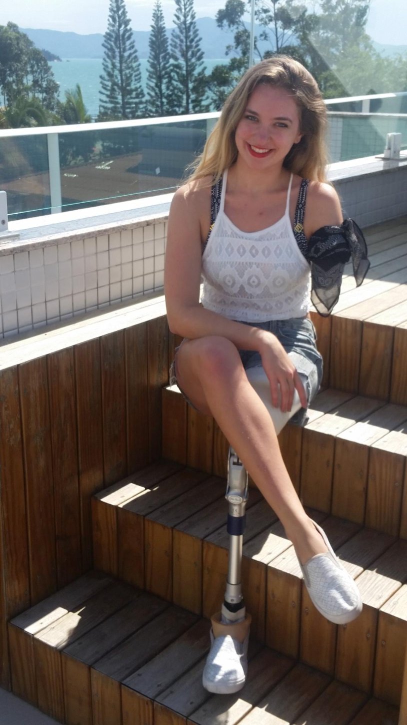 Amputee Irina Stoyanova