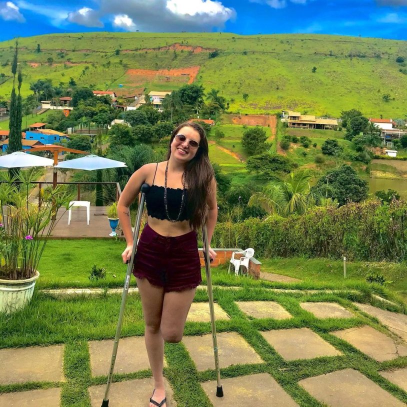 Women amputa drivers