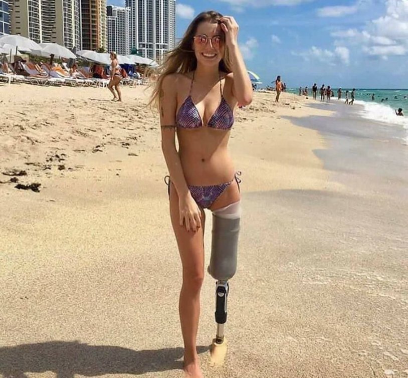 Amputee dak Anastasia Belkovskpy