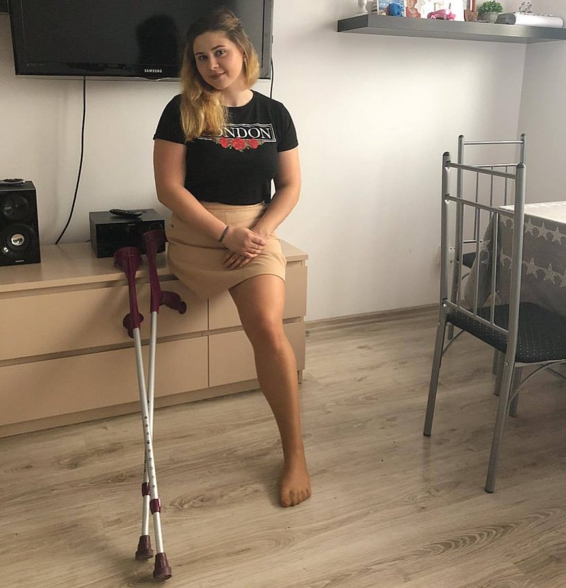 Women amputi on crutches at home