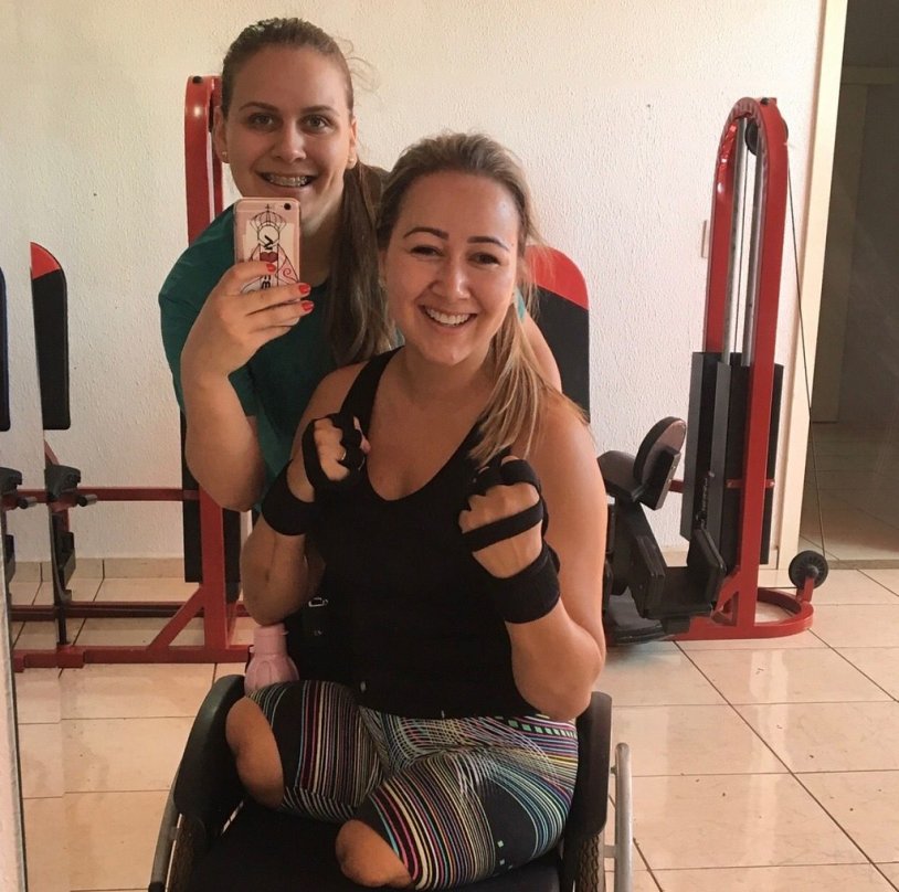 Natasha Vinogradova amputa