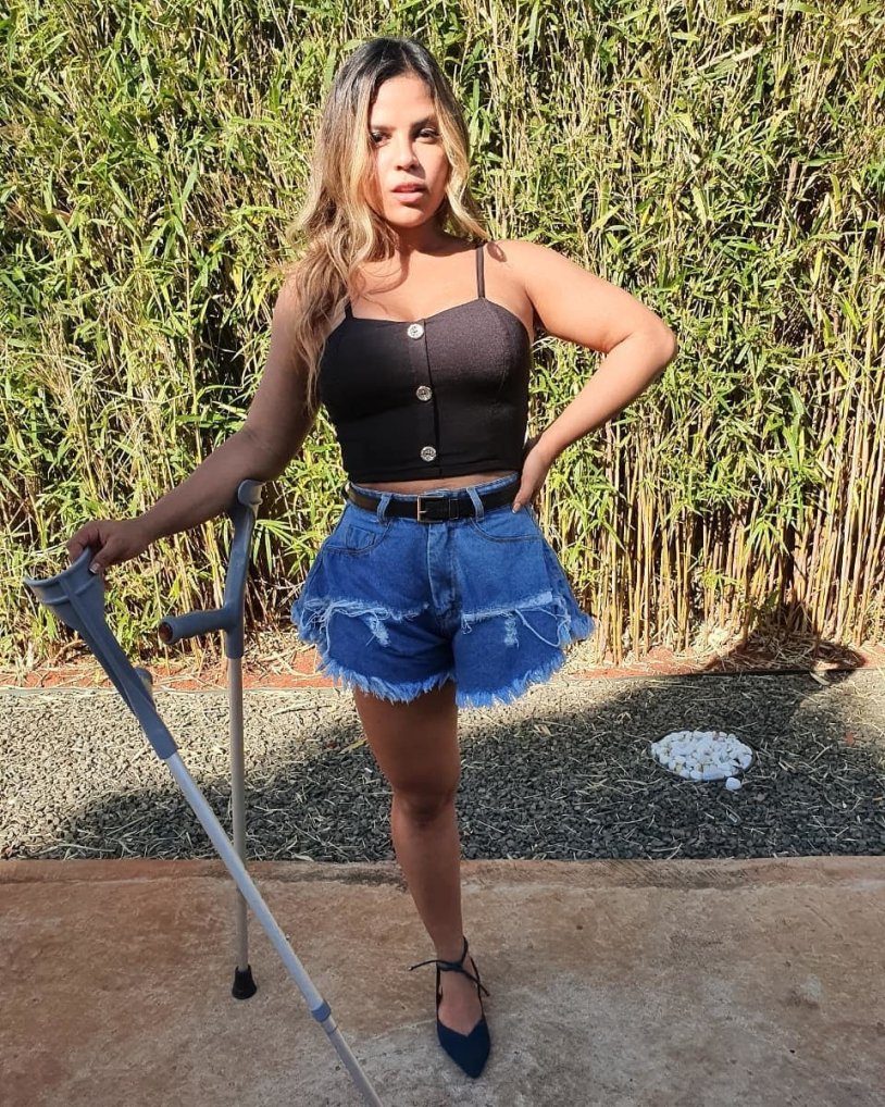 Women disabled without legs