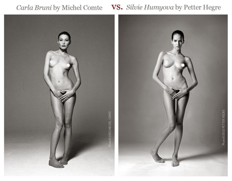 Karl Bruni Naked Tits