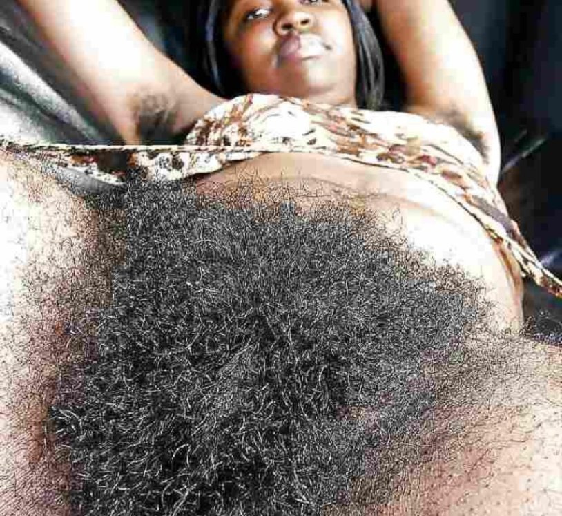 Hairy woman
