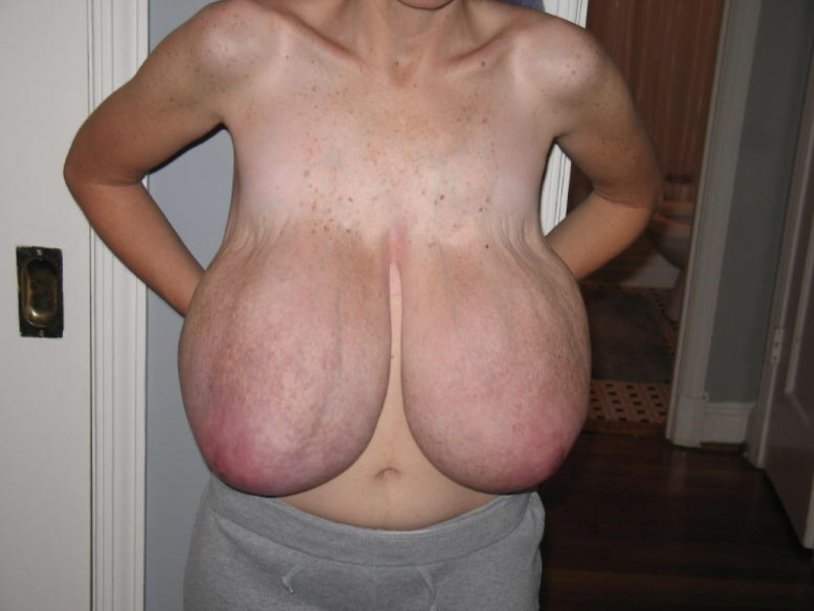 Giantomastia big boobs