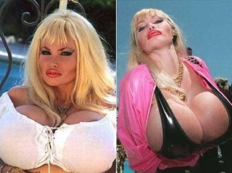 Wandy Utpers Lisa Lipps