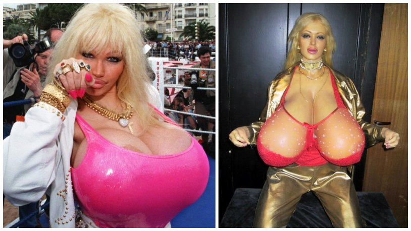 Lolo Ferrari to plastic