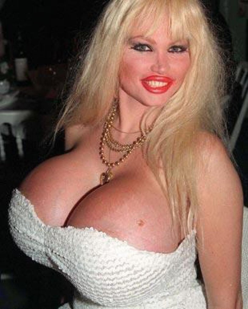 Lolo Ferrari before and after surgery