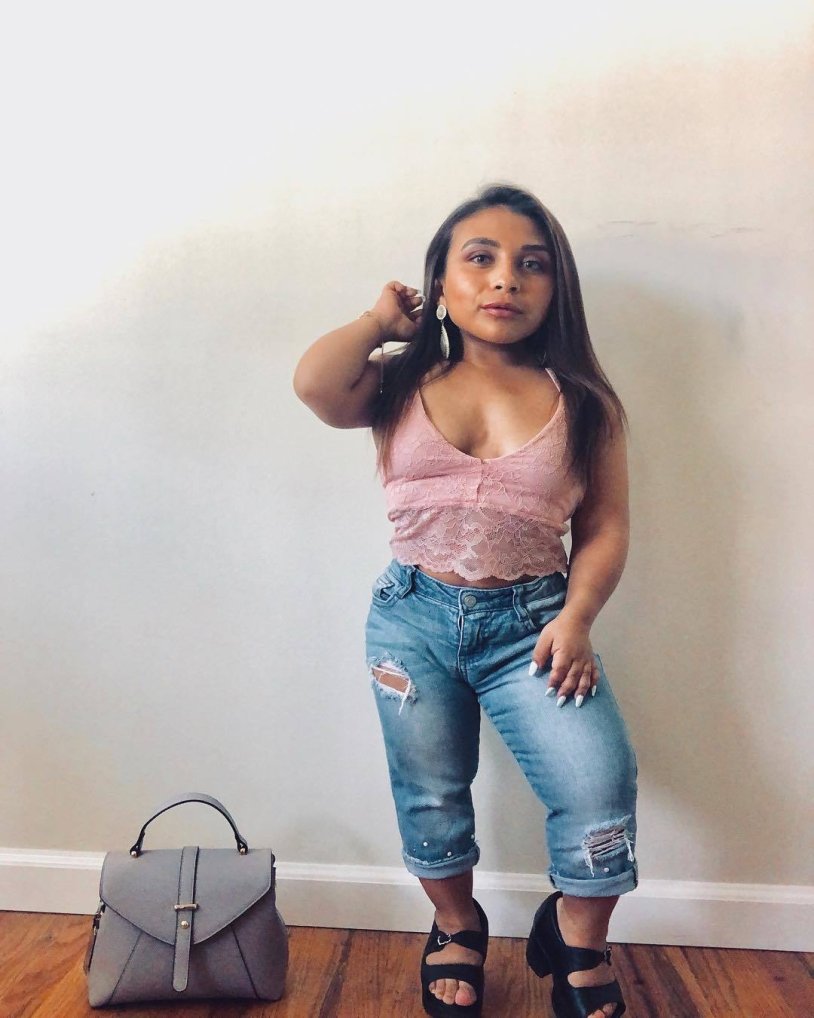 Dwarf model Drew Prest