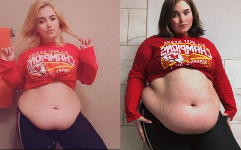 Fidi Chabby Gerls before and after