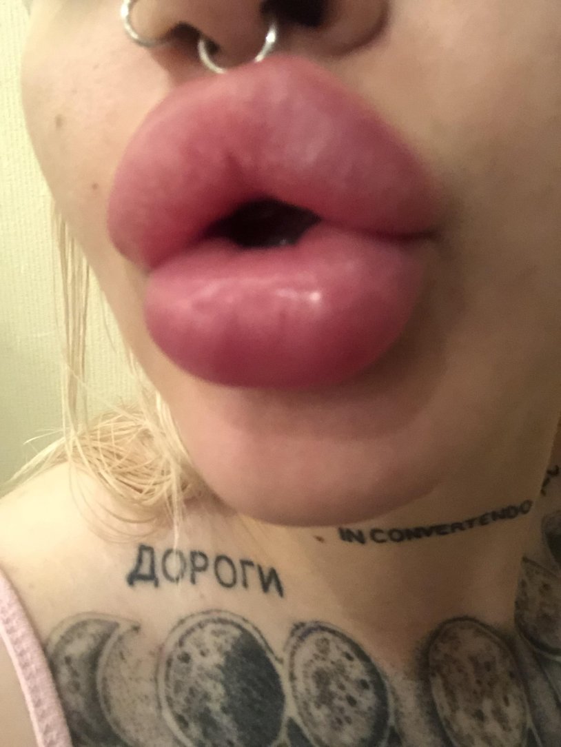 Shnek for Zitrek ST3000