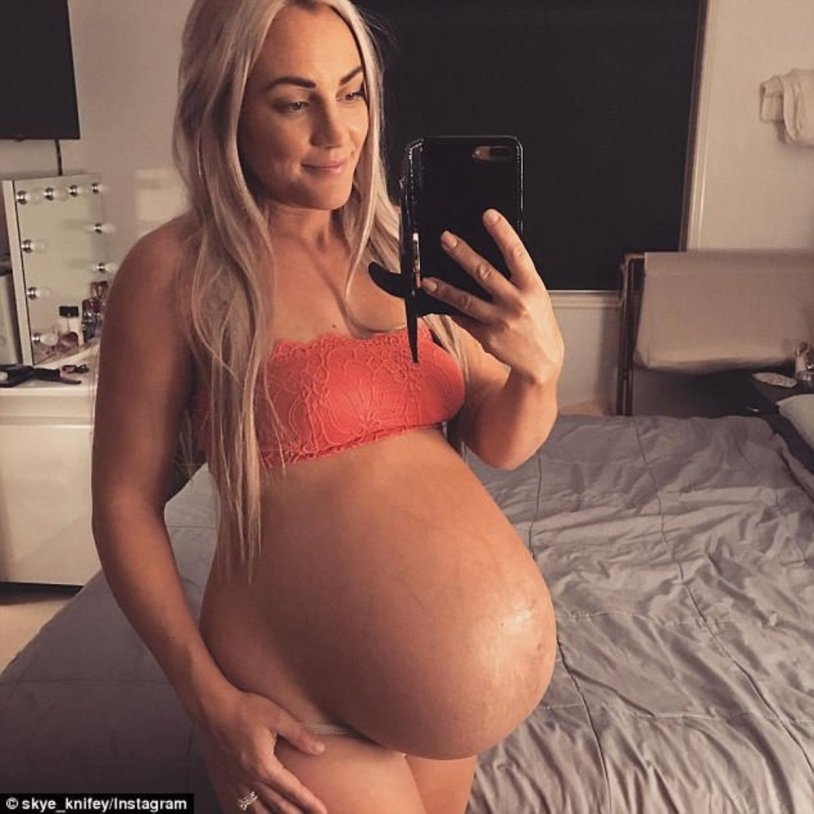 Mackenzie Star Pregnant