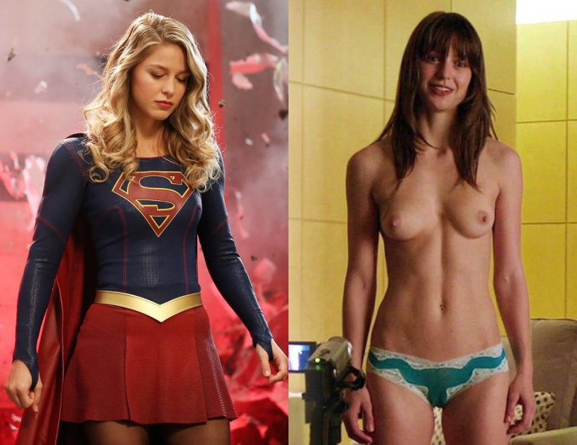 Super Gulle XXX Melissa Benoist