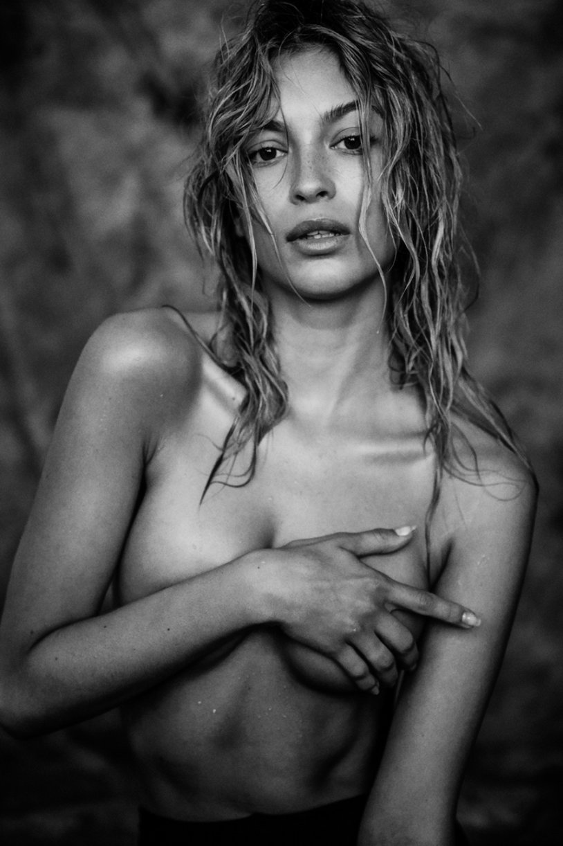 Cassie van anorexia nude