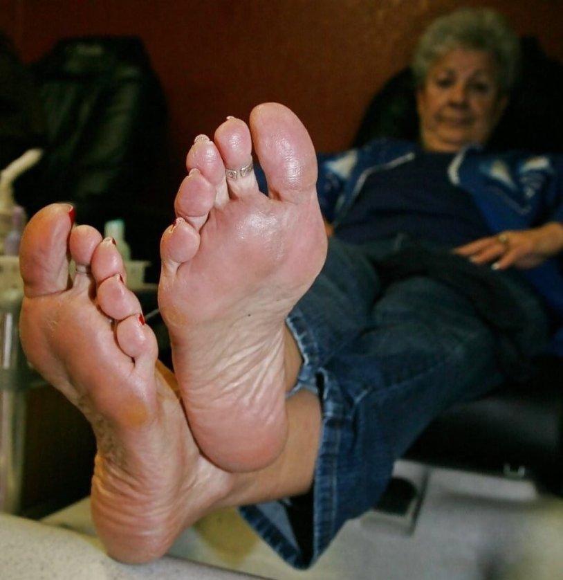 Legs of elderly women