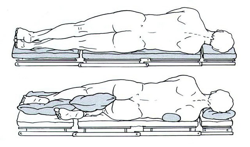 Mechanical Ventilation in Prone Position photo