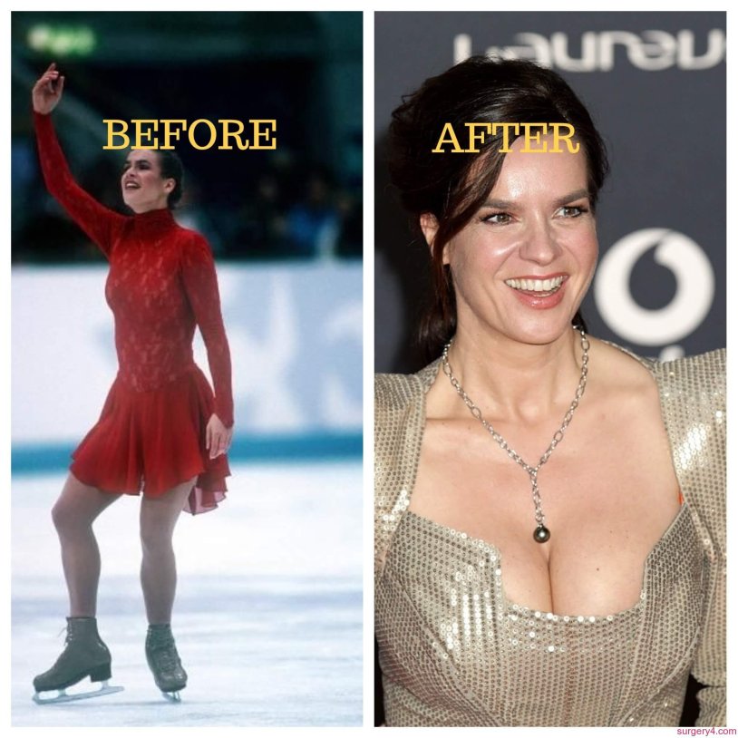Katarina Witt photo in playboy