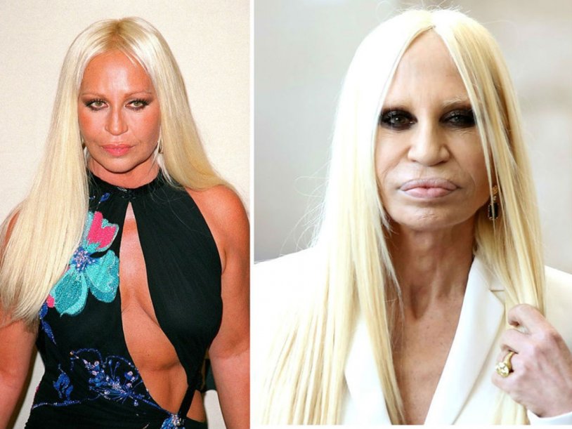 Donatella Versace breasts