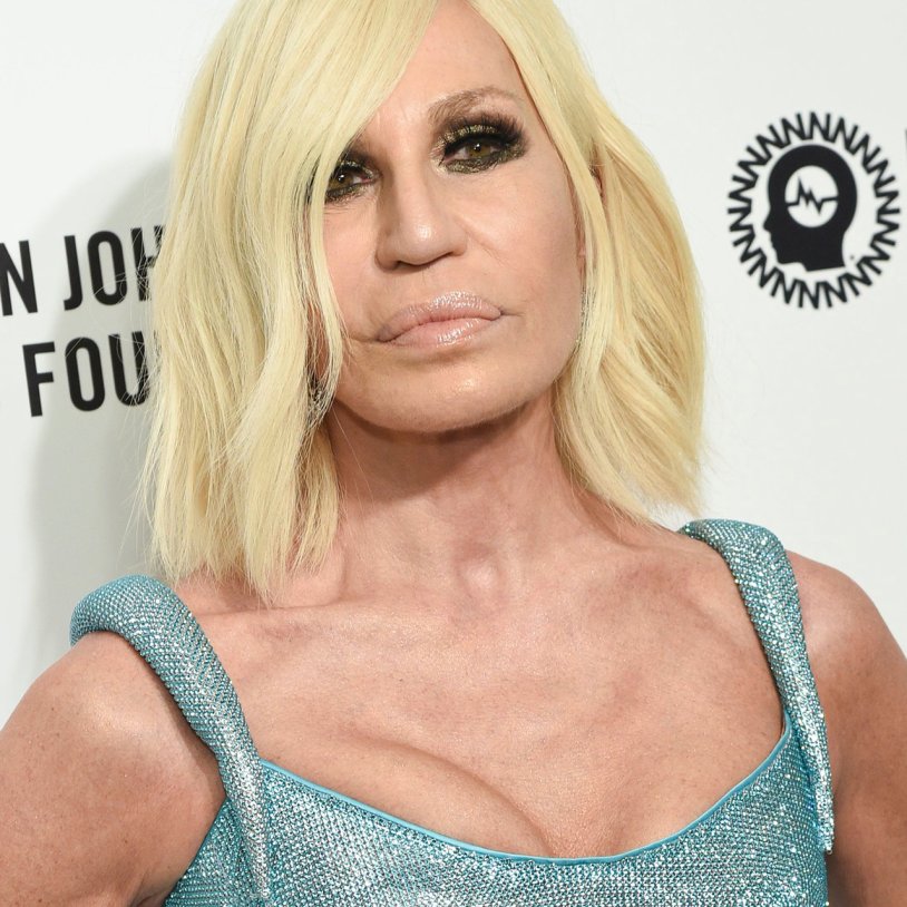 Donatella Versace unsuccessful plastic