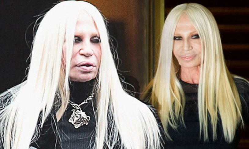 Donatella Versace unsuccessful plastic