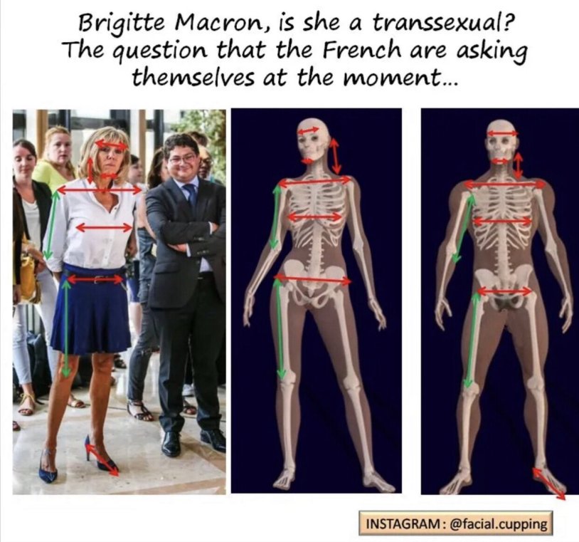 Macron Transgender