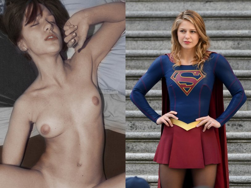 Melissa Benoist Fappening