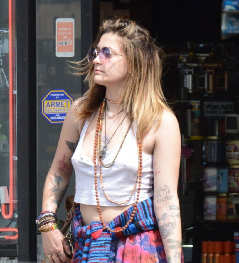 Paris Jackson Vitiligo