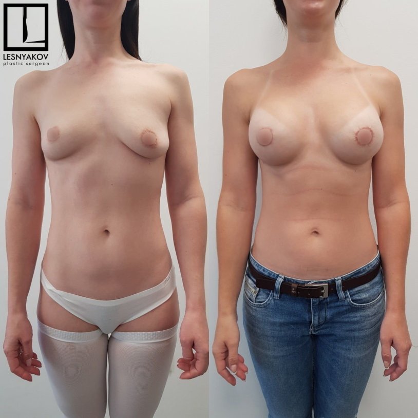 A Small Selection of Uneven and Asymmetric Tits