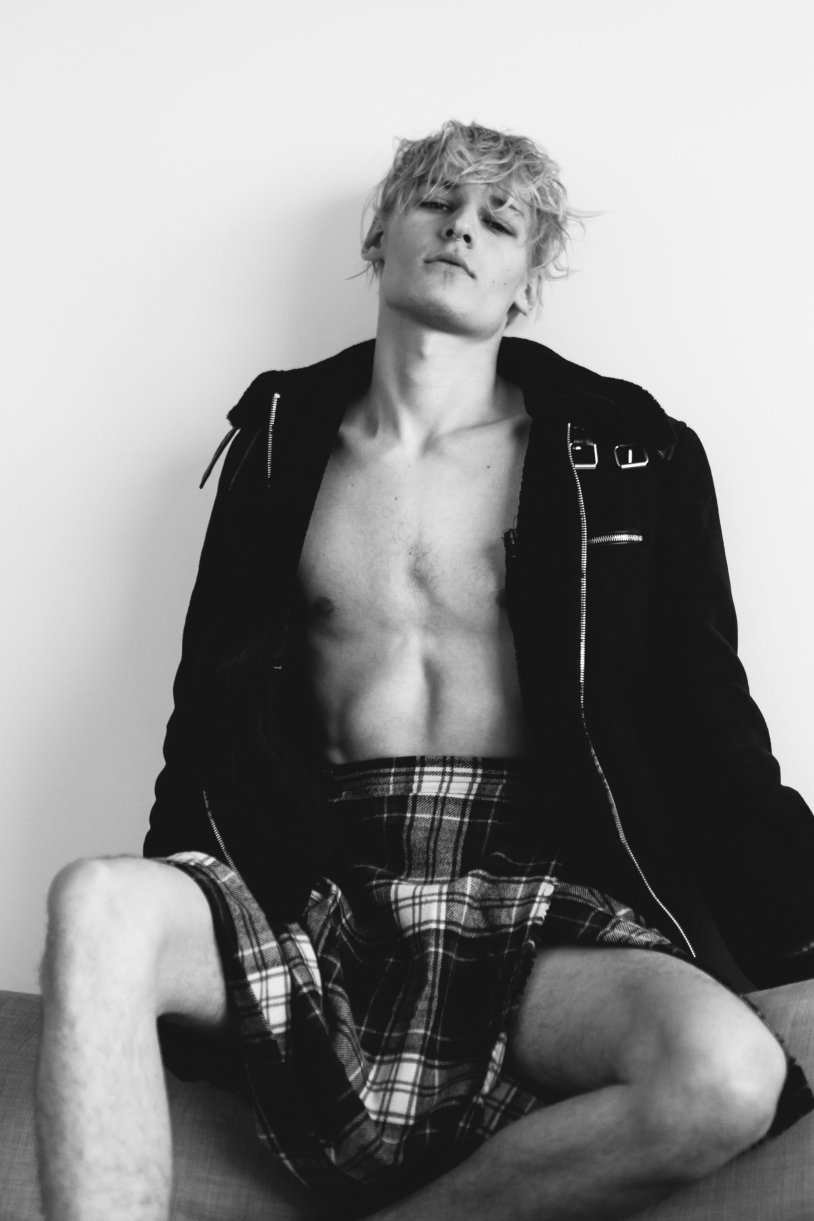 White hair throughout the body