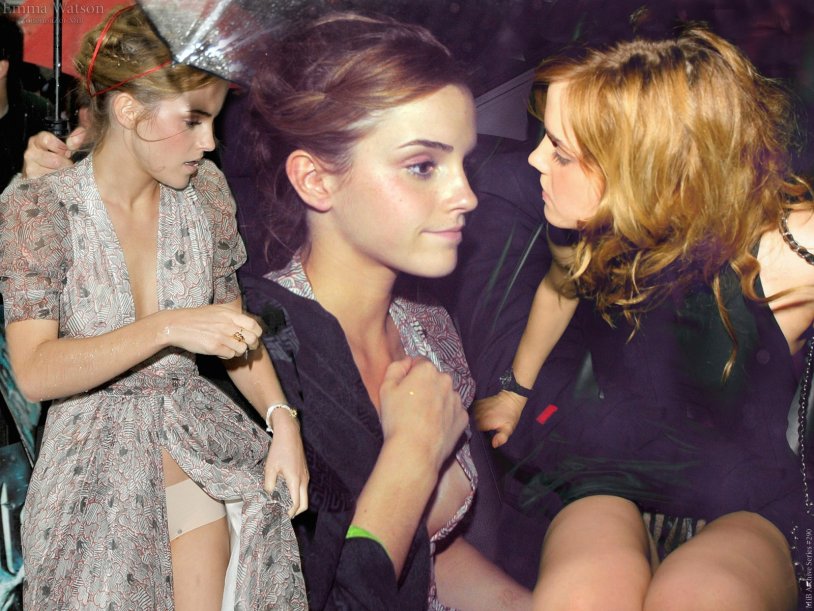 Emma Watson FAP