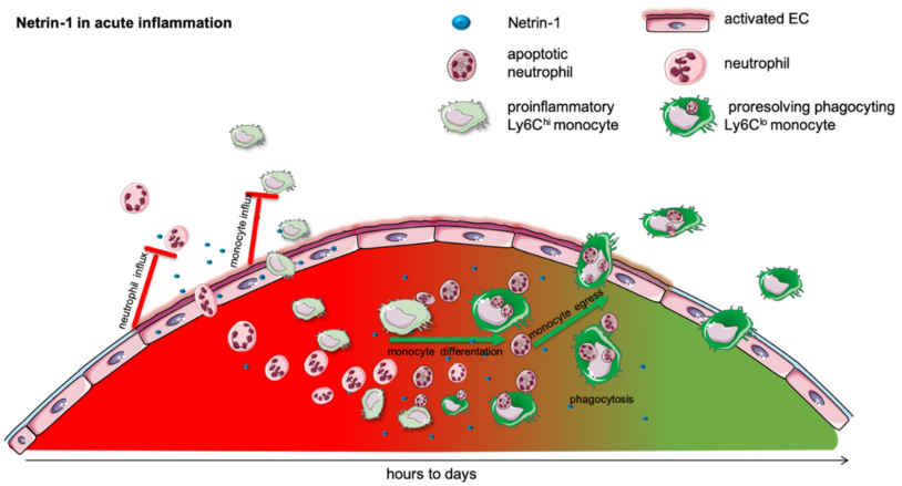Acute inflammation