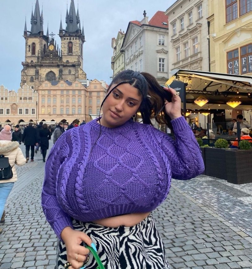 Gigantomastia (hypermastia, macromastia)