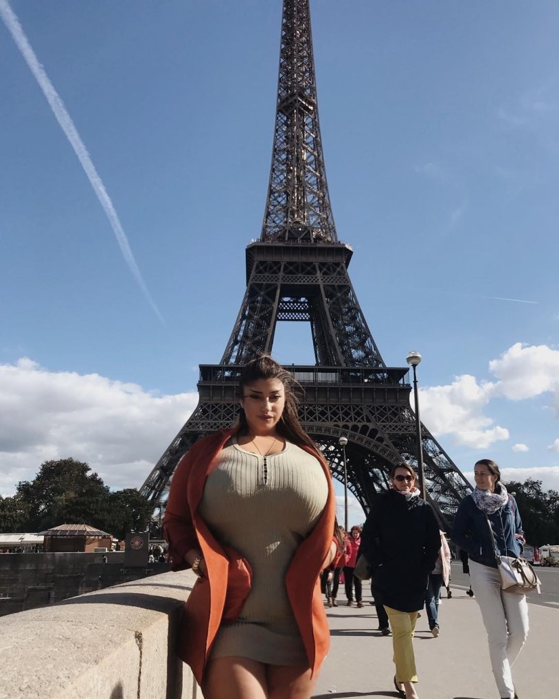 Svetlana Romanova gigantomastia