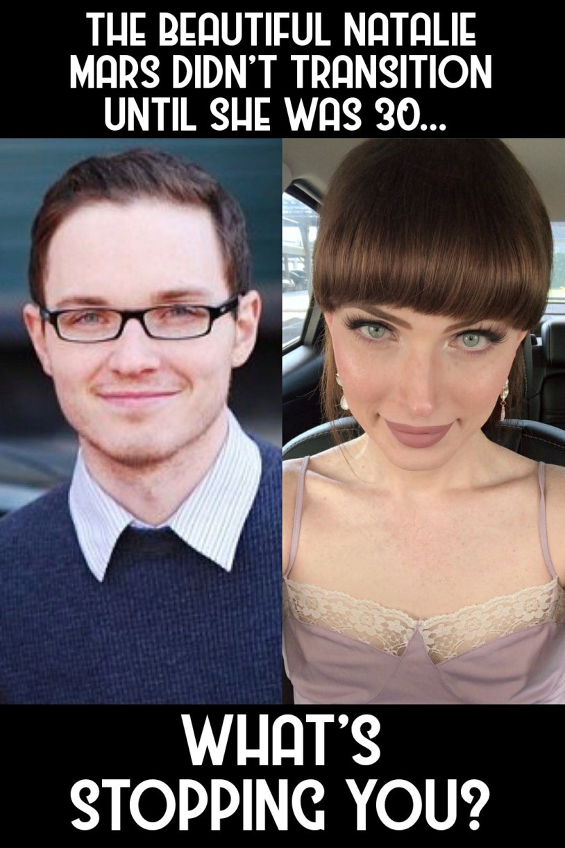 Natalie Mars before surgery