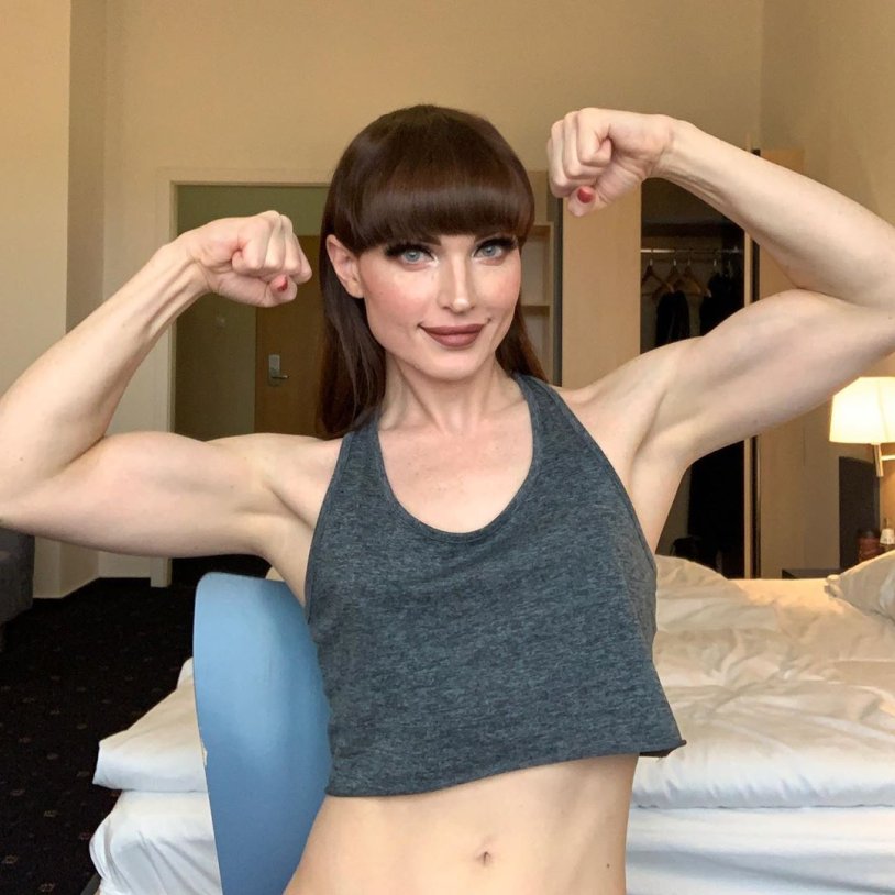 Natalie Mars Natalie Mars before surgery