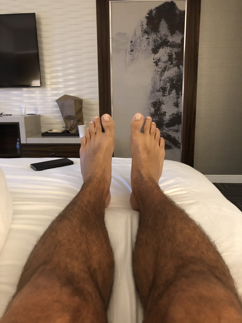 Hairy leg