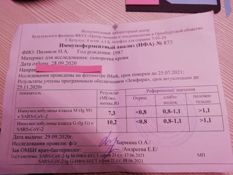 Antibodies G to the Epstein Barr Virus Norm