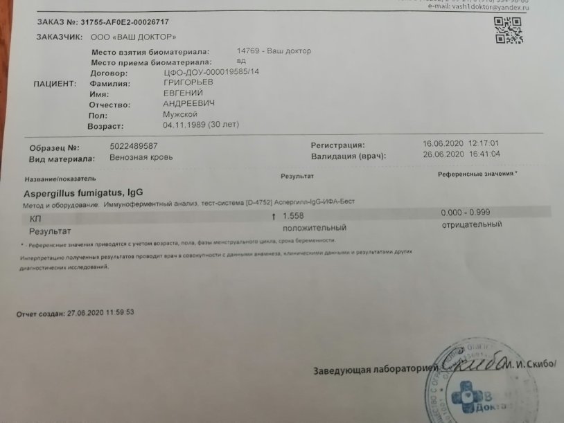 Starks in the circle of the head