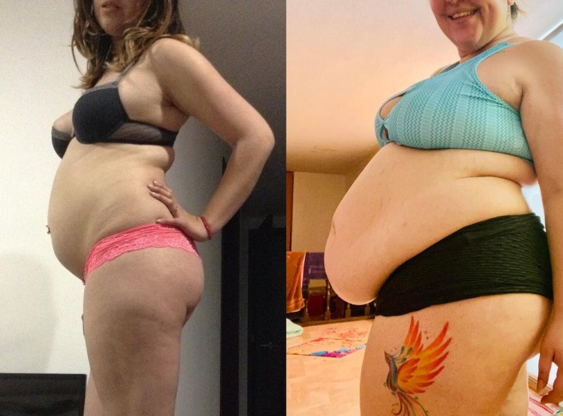 Fiderism before and after a girl