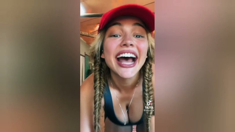 Valya Carnival opened her mouth