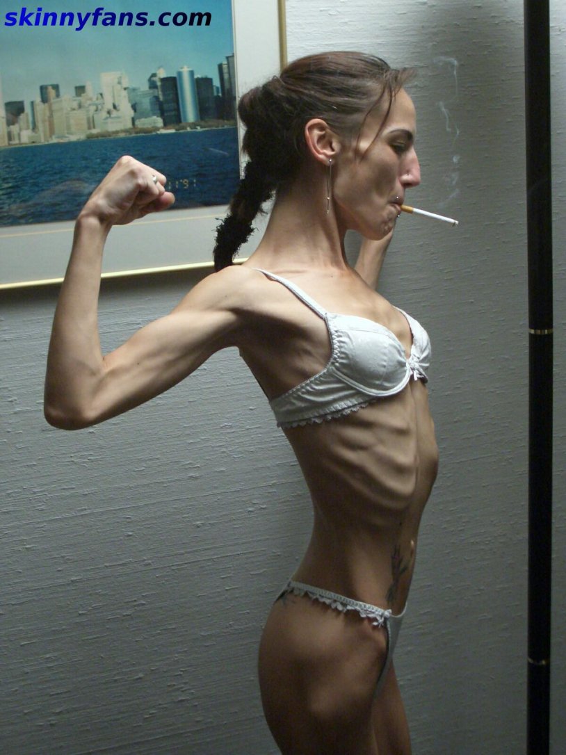 Lina Yegevskaya anorexia